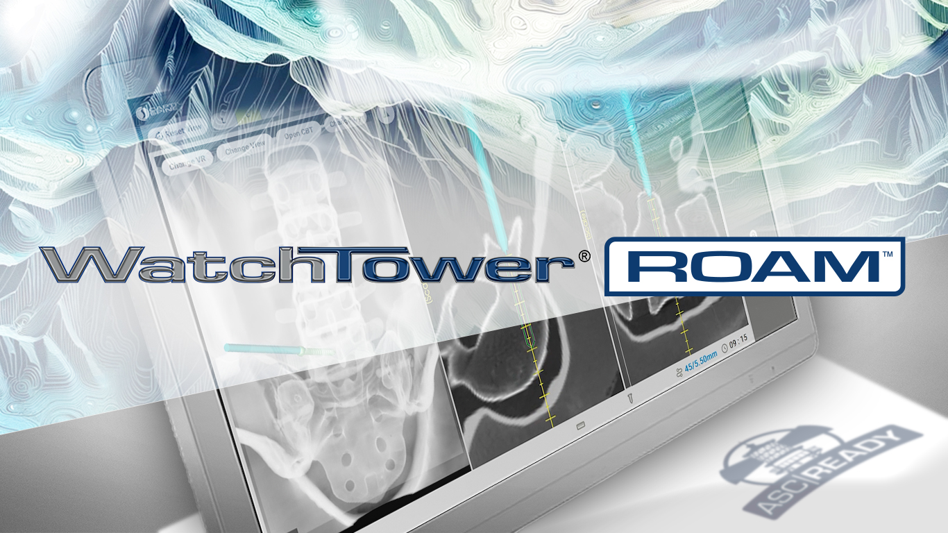 WatchTower ROAM Spine Navigation System